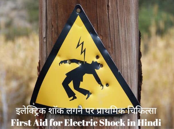 इलेक्ट्रिक शॉक लगने पर प्राथमिक चिकित्सा First Aid for Electric Shock in Hindi, प्राथमिक चिकित्सा की पूरी जानकारी हिन्दी में First Aid in Hindi [Complete Guide]