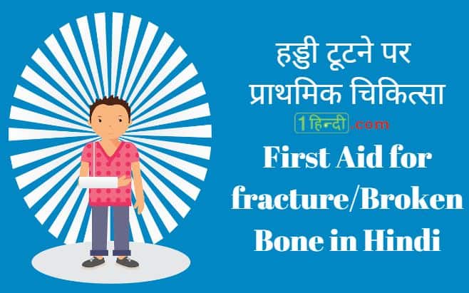 हड्डी टूटने पर प्राथमिक चिकित्सा First Aid for fracture/Broken Bone in Hindi,प्राथमिक चिकित्सा की पूरी जानकारी हिन्दी में First Aid in Hindi [Complete Guide]