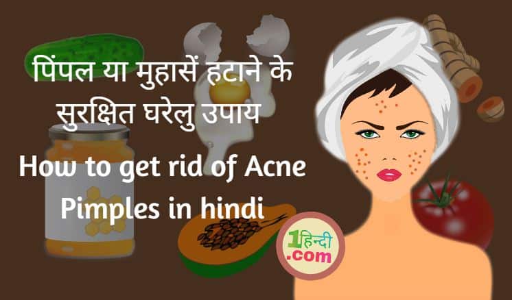 पिंपल या मुहासें हटाने के सुरक्षित उपाय How to get rid of Acne Pimples in Hindi