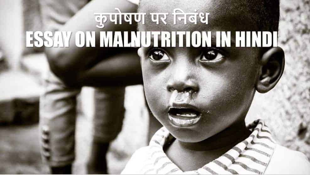 कुपोषण पर निबंध Essay on Malnutrition in Hindi