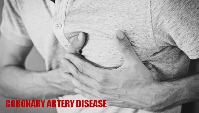 कोरोनरी आर्टरी डिजीज हृदय रोग, लक्षण, इलाज Coronary Artery Disease in Hindi, Cause, Symptoms, and Treatment