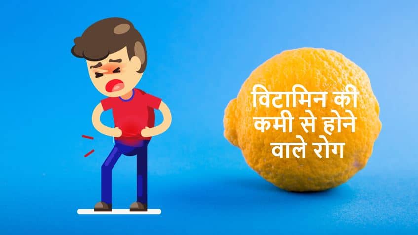 विटामिन की कमी से होने वाले रोग Vitamin Deficiency Diseases in Hindi