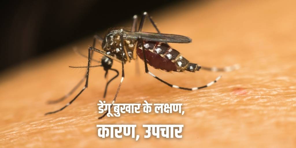 डेंगू बुखार के लक्षण, कारण, उपचार Dengue Fever Causes Symptoms Treatment in Hindi